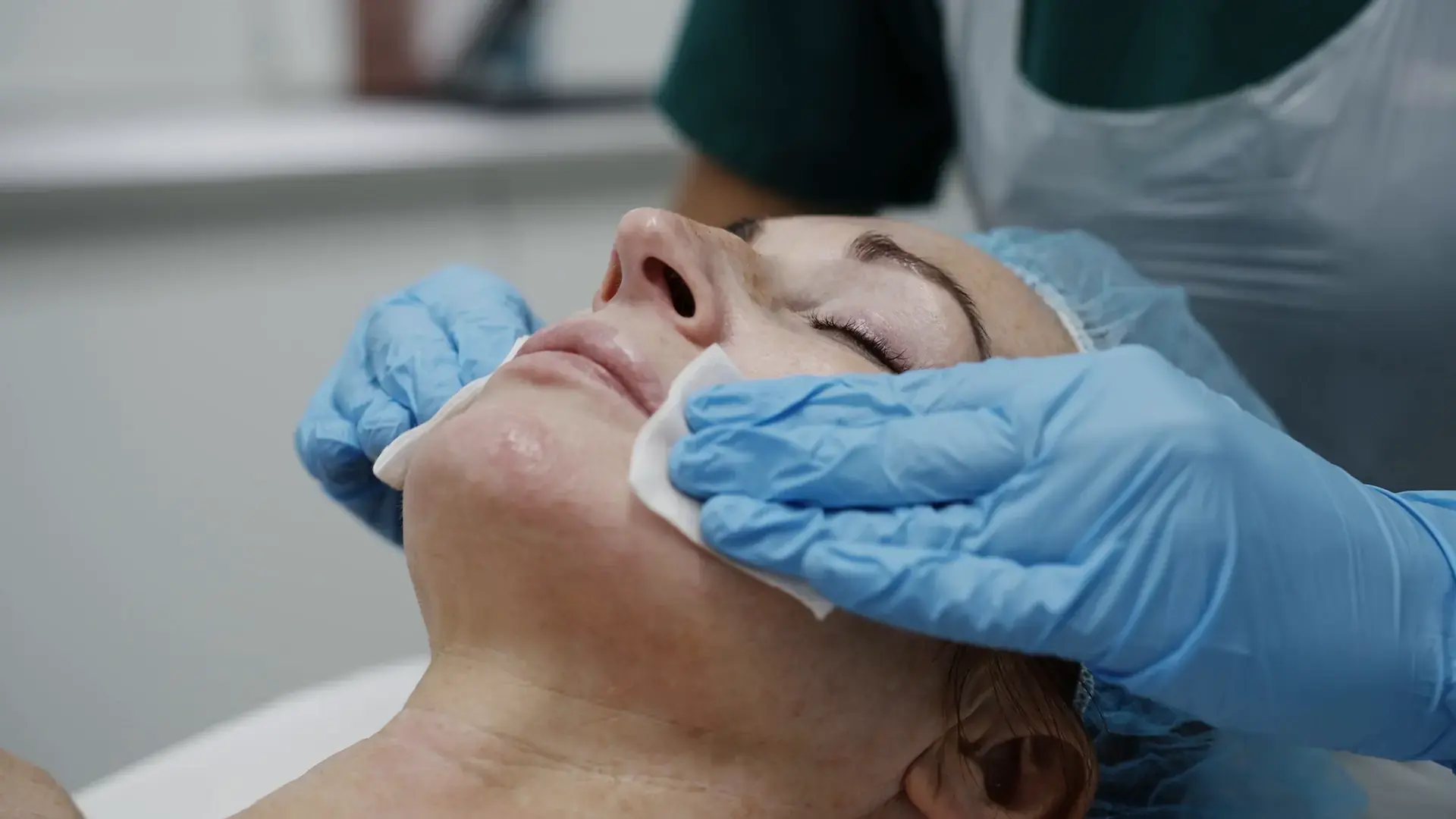 A practitioner wipes a client's face with gloved hands during a chemical peel