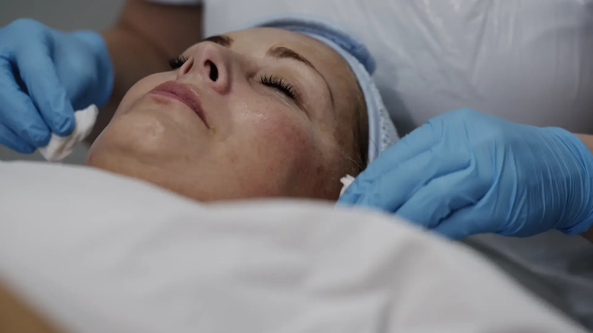 A client lies with eyes closed while a practitioner's gloved hands hold a swab to her face
