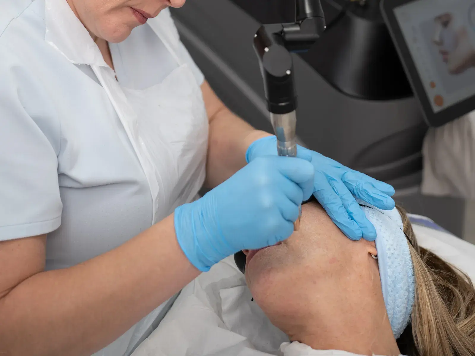 Gloved hands guide an erbium laser handpiece across a client's forehead