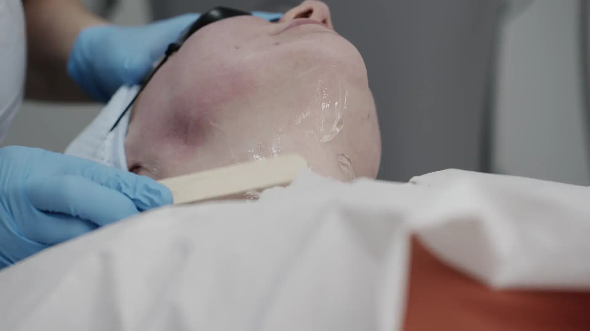 A client's chin and neck covered in clear gel with a spatula beside them