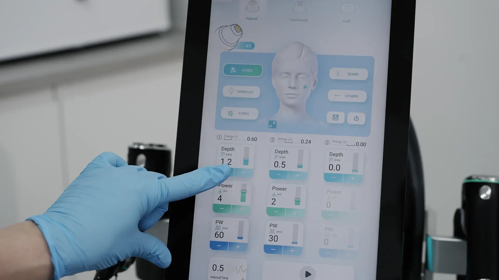 A practitioner's gloved finger touches a touchscreen showing depth settings