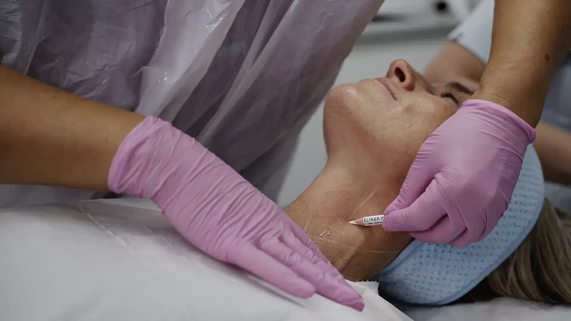 A practitioner's gloved hands treat a client's jawline during a HIFU session