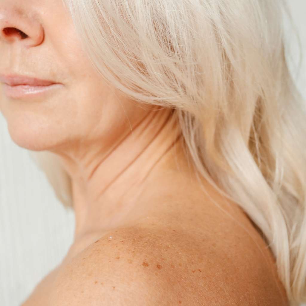 cryotherapy lancaster